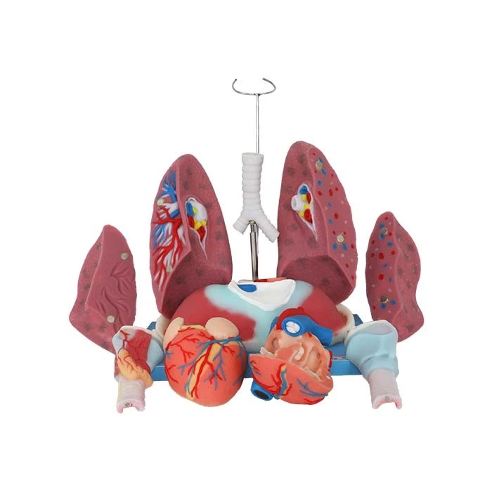 Human Lung Anatomy Model